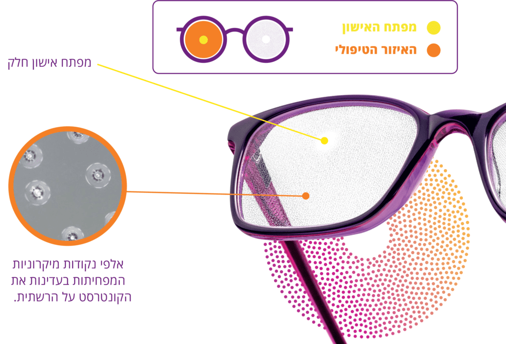 הטכנולוגיה של משקפי MiSight