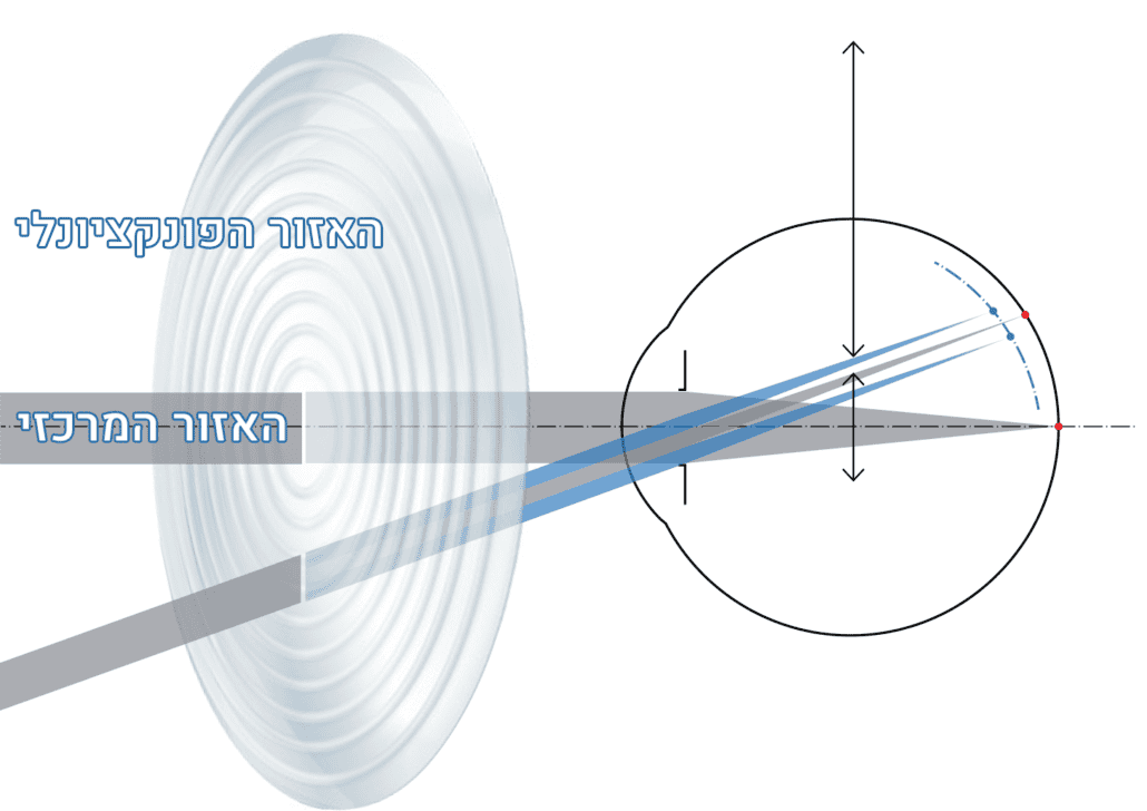 עדשות Zeiss MyoCare להאטת מיופיה